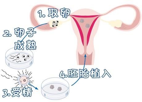 42岁高龄二胎成功案例